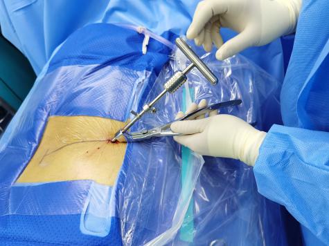 2025新澳门开门原料免费