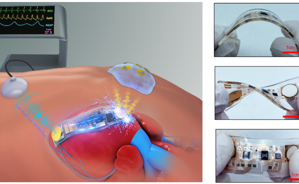 2025新澳门开门原料免费