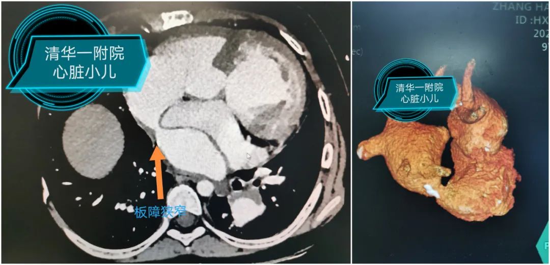 2025新澳门开门原料免费