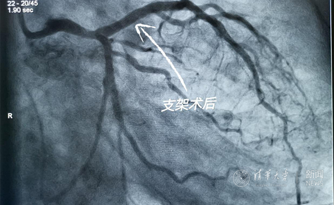 2025新澳门开门原料免费